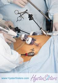 foto 9 b instrumentos laparoscopia
