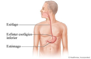 gastroenterologo-en-merida-que-es-el-reflujo-y-la-enfermedad-por-reflujo-gastroesofagico