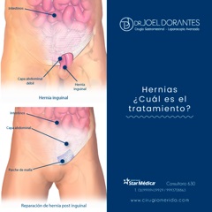 imagen-5-tratamiento-de-hernia-inguinal