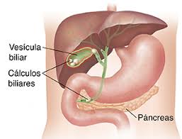 operacion-de-vesicula