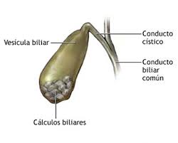 sintomas-de-vesicula